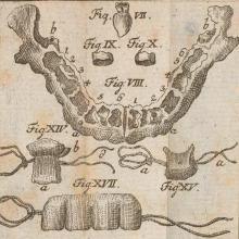Tab. VI from Philip Pfaff's "Abhandlung von den Zähnen des menschlichen Körpers und deren Krankheiten" (RK301 P53 1756)